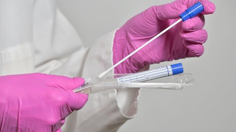 V ponedeljek so opravili 567 testiranj, potrdili tri okužbe