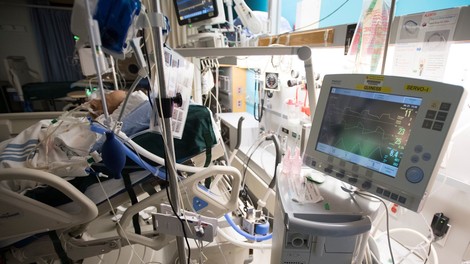 Trenutno je v Sloveniji 439 ventilatorjev za zdravljenje bolnikov s covidom-19