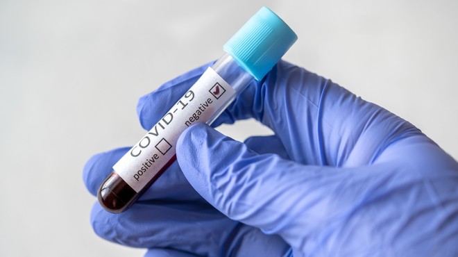 Ob 300 testiranjih v Sloveniji odkrili štiri nove okužbe (foto: Profimedia)