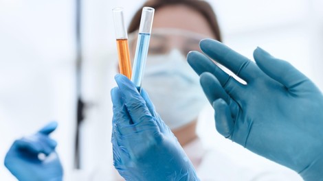 V nedeljo ob 530 testiranjih potrdili 16 okužb