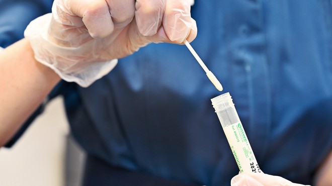 V torek v Sloveniji potrdili 24 novih okužb s koronavirusom (foto: Profimedia)