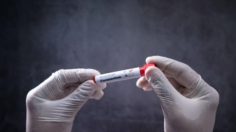 V ponedeljek opravili 1218 testov in potrdili 10 primerov okužbe