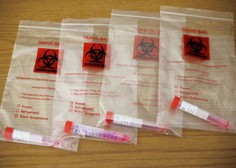 Policija zasegla 17.000 lažnih testov za novi koronavirus