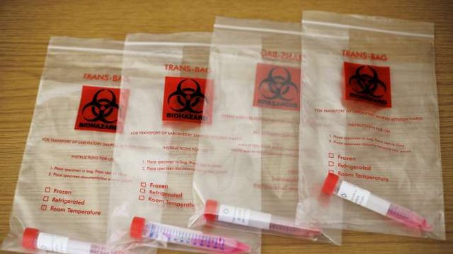 Policija zasegla 17.000 lažnih testov za novi koronavirus (foto: Daniel Novakovič/STA)