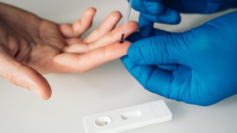 Hitri testi v Sloveniji le za življenjsko ogrožene bolnike