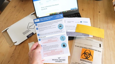 Na Švedskem 3700 ljudi lažno pozitivnih na koronavirus