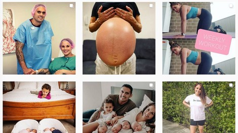 30-letna Avstralka na Instagramu s fotografijo trebuha, ki ji je ostal po četvorčkih