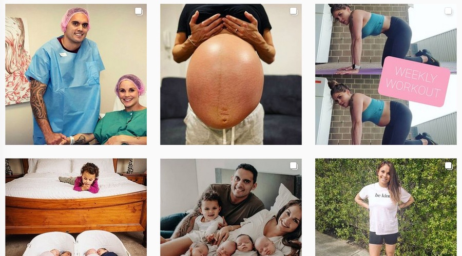 30-letna Avstralka na Instagramu s fotografijo trebuha, ki ji je ostal po četvorčkih (foto: Instagram)