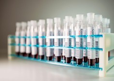 Kitajska se pridružuje pobudi za pravično razdeljevanje cepiva proti covidu-19
