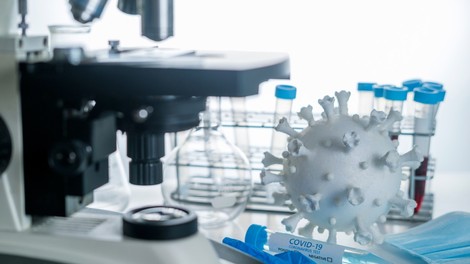 Znanstvenikom iz Oxforda uspelo razviti 5-minutni test za covid-19