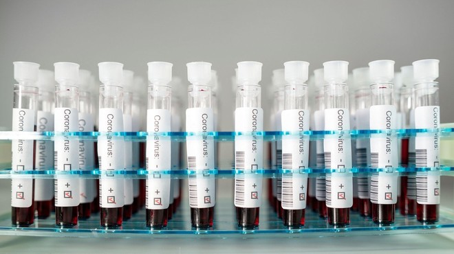 Na Kitajskem novo množično testiranje na novi koronavirus (foto: profimedia)