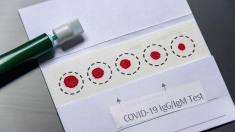 Hitri antigenski testi so manj zanesljivi od testov PCR. Kako natančni pa so slednji?