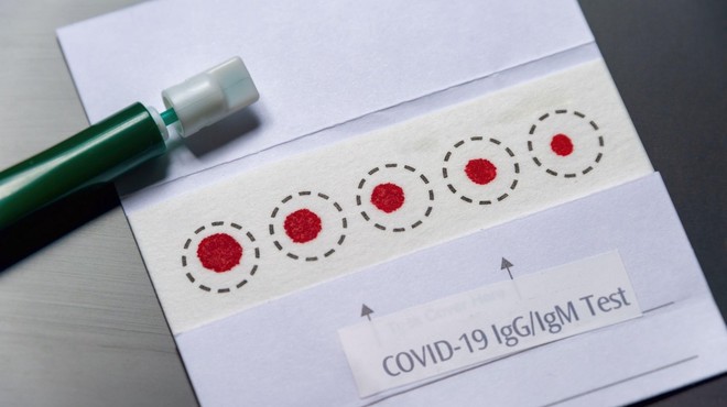 Hitri antigenski testi so manj zanesljivi od testov PCR. Kako natančni pa so slednji? (foto: profimedia)