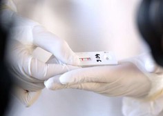 UKC Ljubljana bo s 27 ponudniki sklenil enoletni okvirni sporazum za nakup hitrih antigenskih testov