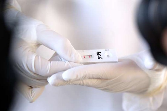 UKC Ljubljana bo s 27 ponudniki sklenil enoletni okvirni sporazum za nakup hitrih antigenskih testov