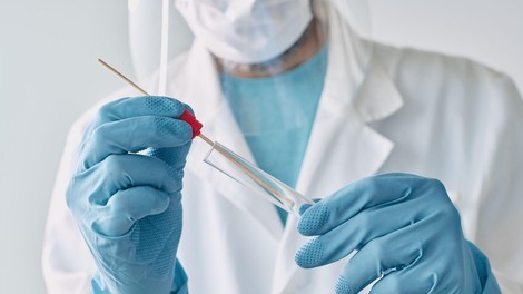 Po ocenah nacionalne raziskave je pri nas prekuženega od 4,16 do 4,40 odstotka prebivalstva