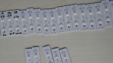 Na ministrstvu za zdravje izbrali dobavitelja za približno pol milijona antigenskih testov