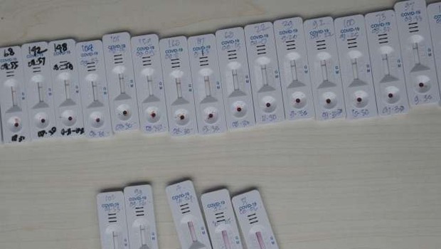 
                            Na ministrstvu za zdravje izbrali dobavitelja za približno pol milijona antigenskih testov (foto: STA)