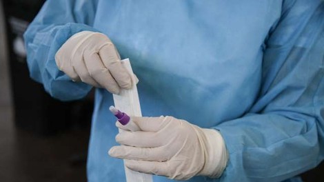 Ambulantni izvidi o prebolelem covidu brezplačni, potrdila ponekod plačljiva