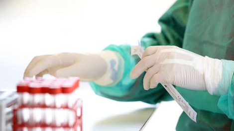 Zaradi pomanjkanja hitrih testov v ZD Celje začasno prekinili testiranja