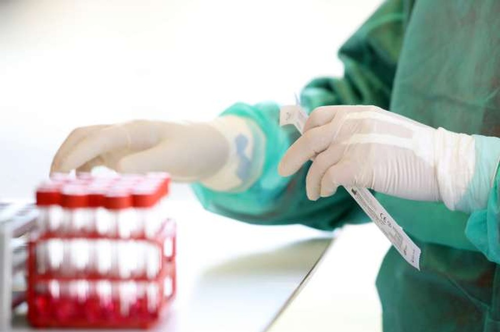Zaradi pomanjkanja hitrih testov v ZD Celje začasno prekinili testiranja (foto: Hina/STA)