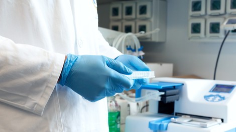 Koronavirus se je na človeka najverjetneje prenesel prek živali gostiteljice