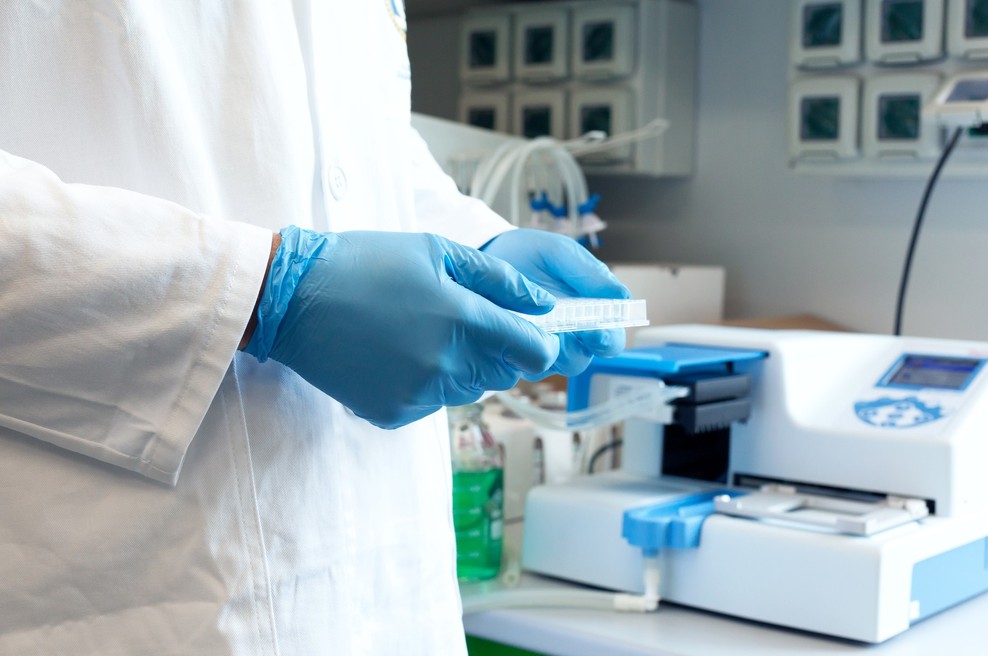 Koronavirus se je na človeka najverjetneje prenesel prek živali gostiteljice (foto: Profimedia)