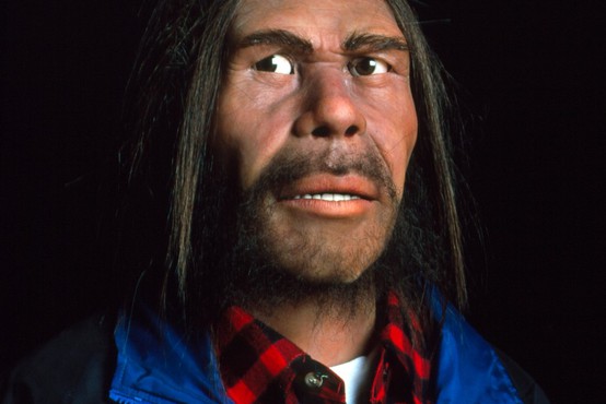 Bi krivca za težjo obliko covida lahko iskali v neandertalskem genu?
