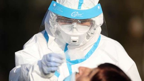 Manj kot petina okuženih s težjim potekom, PCR testi bi morali biti brezplačni