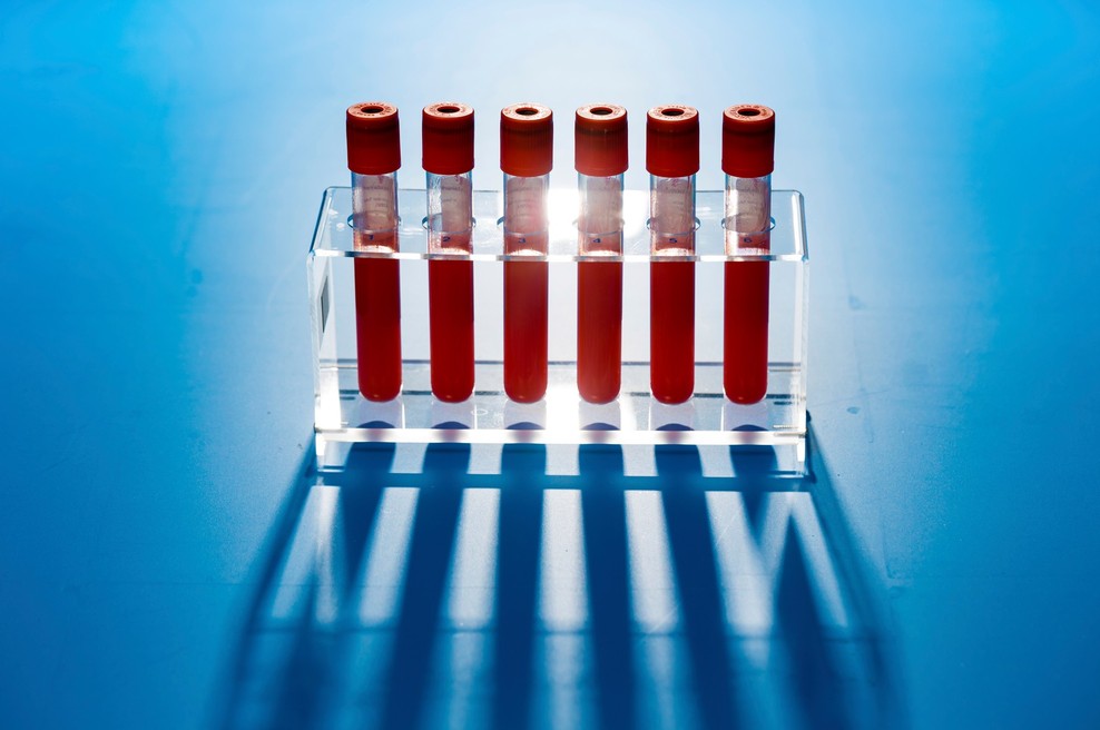 Imunost na koronavirus bi lahko trajala več let (morda celo doživljenjsko)! (foto: profimedia)