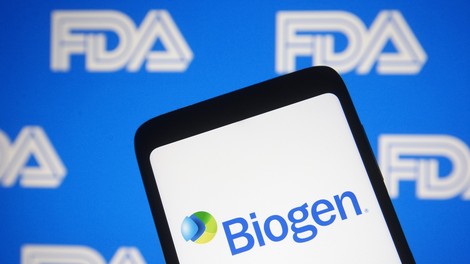 FDA bo preiskala odobritve spornega zdravila za Alzheimerjevo bolezen