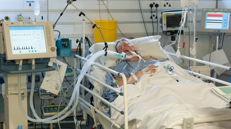 Obširna britanska raziskava opozorila na zaplete po covidu-19 tudi pri mlajših