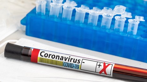 Po sekvenciranju pri nas potrdili 248 primerov različice virusa delta