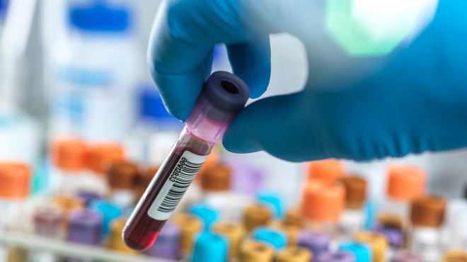 V postopku testiranja krvni test, s katerim bi lahko odkrili kar 50 vrst raka (foto: Profimedia)