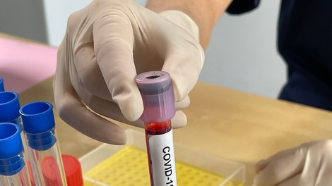 V petek skoraj petina pozitivnih vzorcev od 6247 opravljenih testov