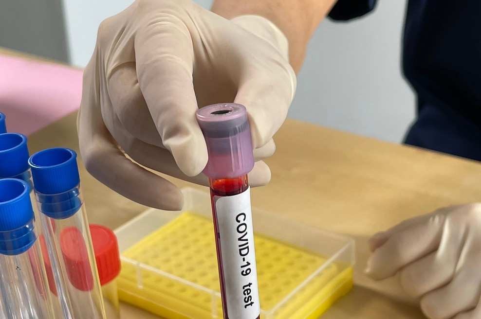 V petek skoraj petina pozitivnih vzorcev od 6247 opravljenih testov (foto: profimedia)