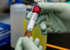 V nedeljo potrdili 1389 okužb z novim koronavirusom (ali 50,9 % opravljenih testov)