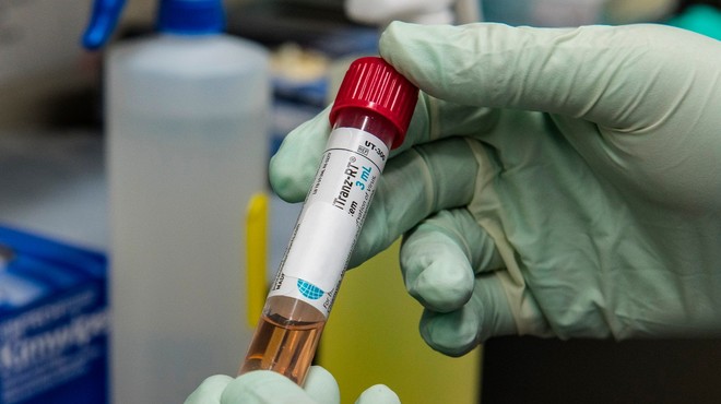 V nedeljo potrdili 1389 okužb z novim koronavirusom (ali 50,9 % opravljenih testov) (foto: profimedia)