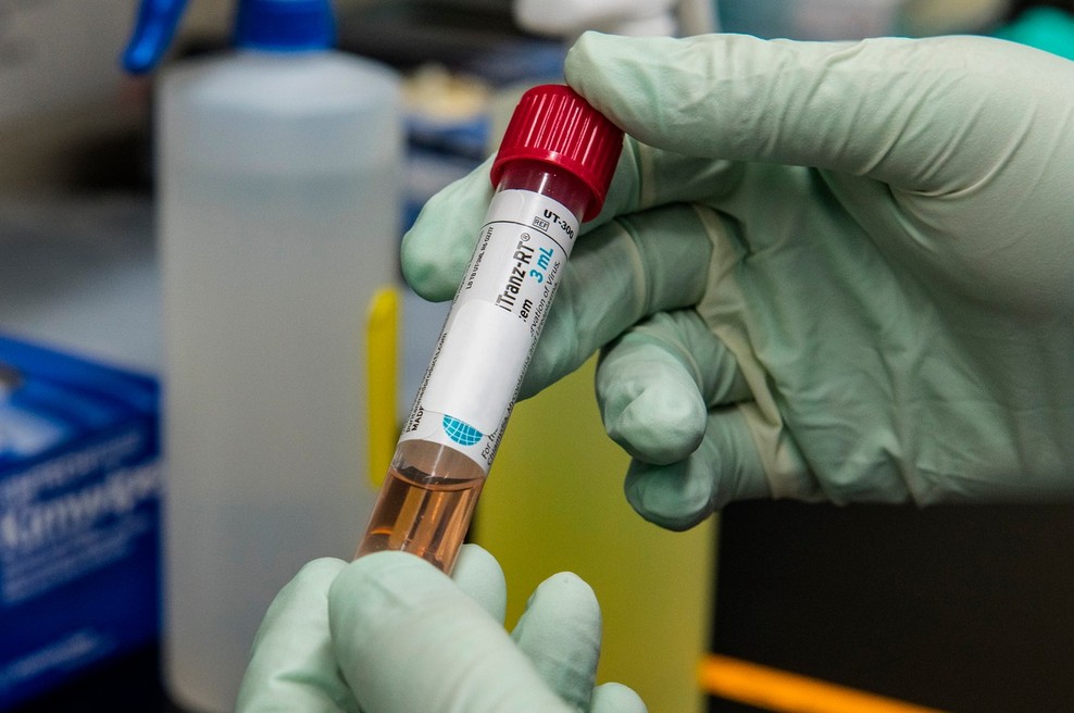 V nedeljo potrdili 1389 okužb z novim koronavirusom (ali 50,9 % opravljenih testov) (foto: profimedia)