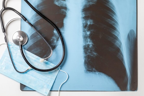 Nemški kardiolog: "Presenetilo nas je, da tudi blagi covid pusti posledice na nekaterih organih!"