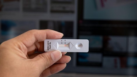 Po spremenjenem protokolu do PCR-testiranja brez pozitivnega hitrega testa le še rizične skupine