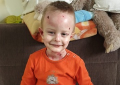 DOBRA NOVICA: Upanje za malega borca Miloša (ki z vašo pomočjo potuje v ZDA na gensko zdravljenje)