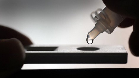 Dva pogoja za skrajšano samoizolacijo: brez vročine in negativni test