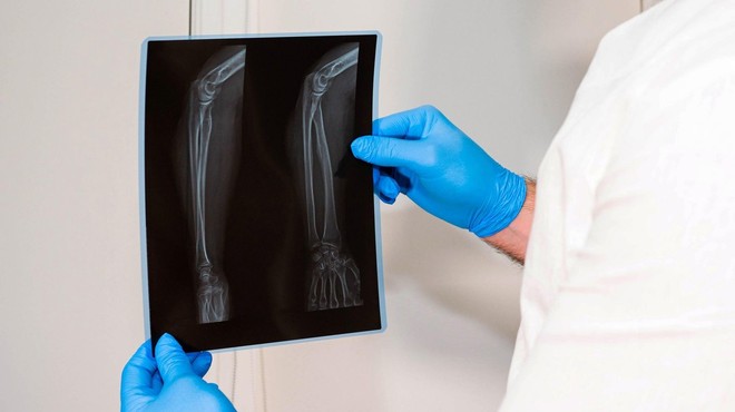 NA SKRIVAJ skušal prodati rentgensko sliko ustreljene pacientke in razkril ... (foto: Profimedia)