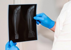 NA SKRIVAJ skušal prodati rentgensko sliko ustreljene pacientke in razkril ...