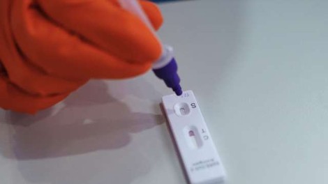 Delo laboratorijev se po spremembi protokola testiranja že umirja