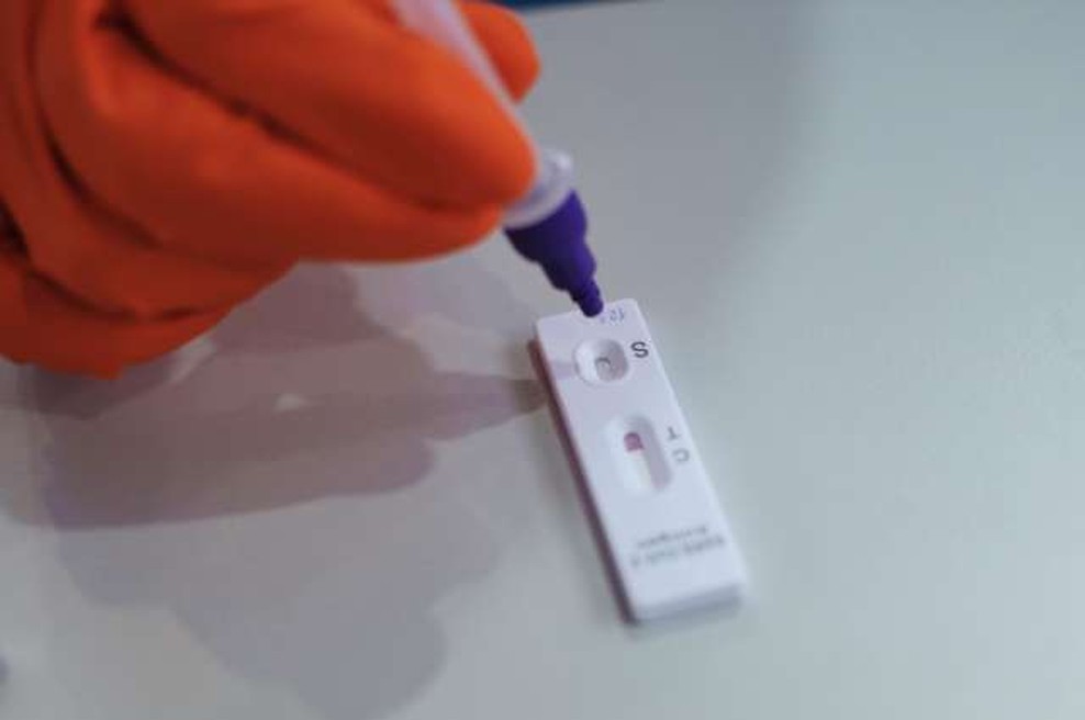 Delo laboratorijev se po spremembi protokola testiranja že umirja (foto: Daniel Novakovič/STA)