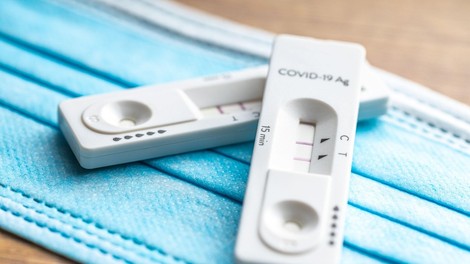 V četrtek opravili 22.270 PCR-testov in potrdili 16.571 okužb