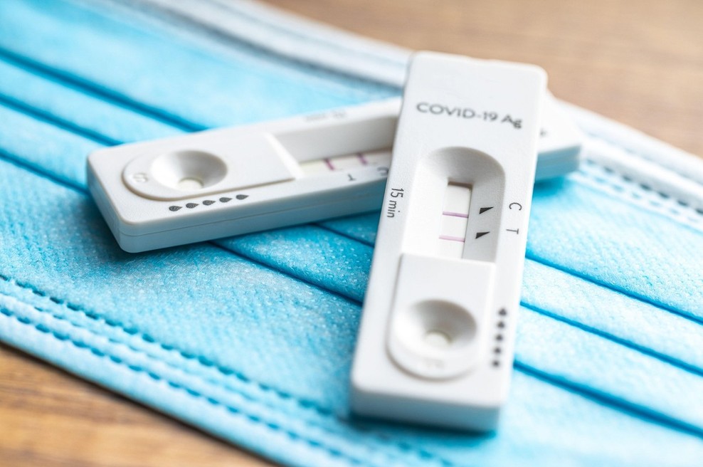 V četrtek opravili 22.270 PCR-testov in potrdili 16.571 okužb (foto: profimedia)