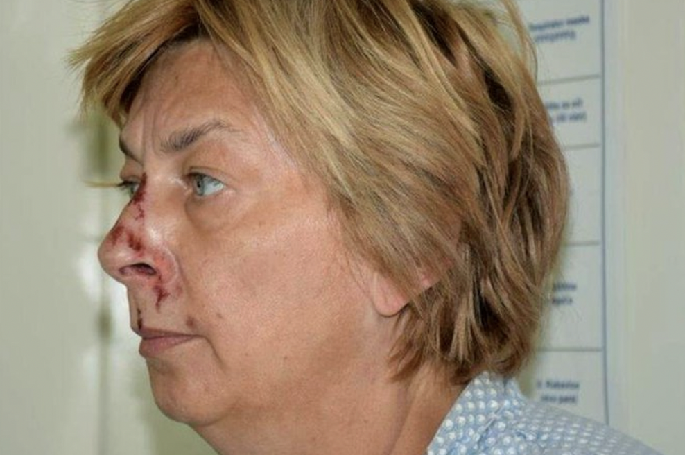 Skrivnostna ženska brez spomina in najdena na Krku razkrila: "Bila sem ugrabljena in želeli so me ubiti." (foto: Posnetek zaslona/Twitter: @ferozwala)